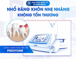 Nhổ răng piezotome tại uông bí