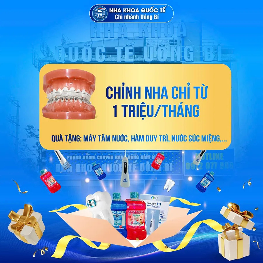 chỉnh nha từ 1tr đồng