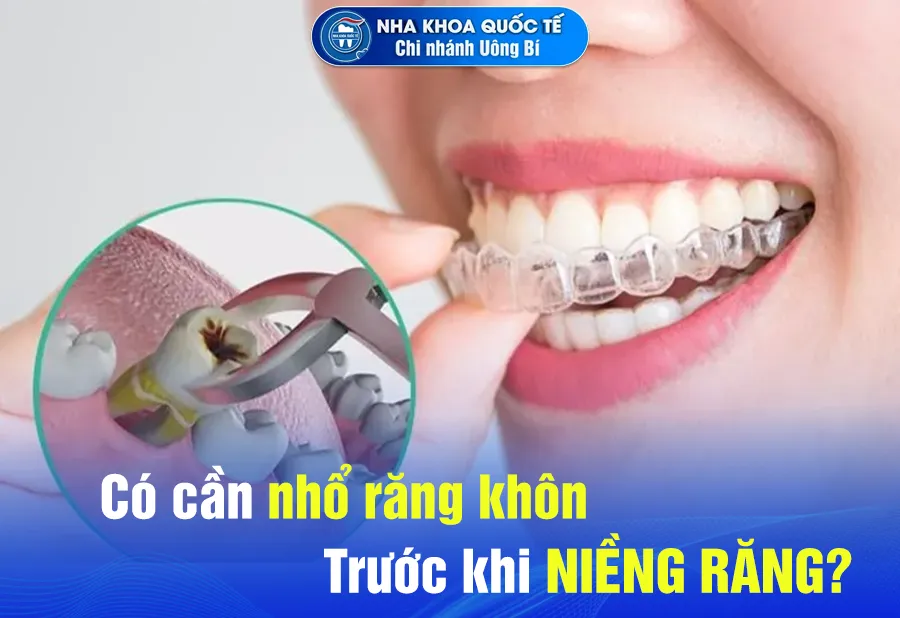 nhổ răng trước khi niềng
