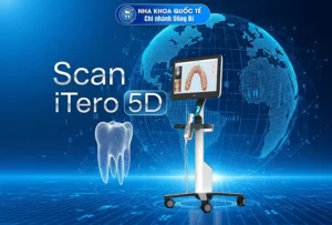 Scan Itero 5D