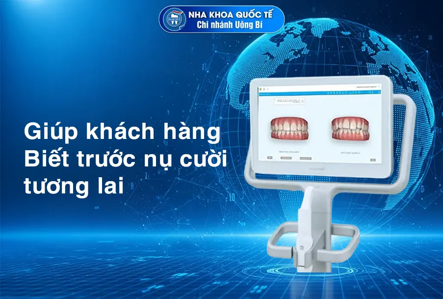 itero Scan 5D biết trước nụ cười tương lai