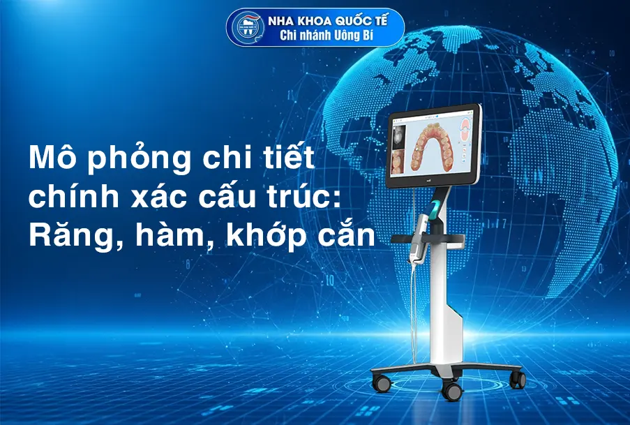 mô phỏng Itero 5D