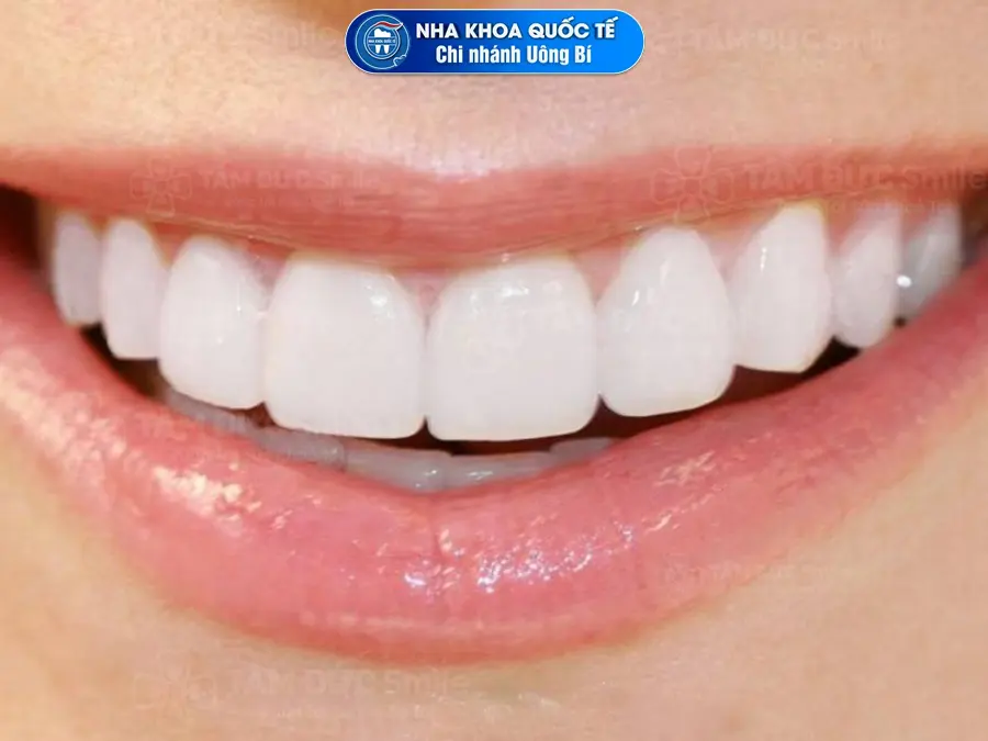 răng đều hạt bắp