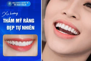 xu hướng thẩm mỹ răng tự nhiên
