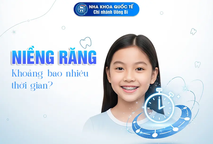 niềng răng bao nhiêu lâu