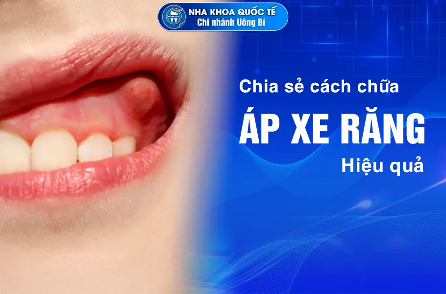 chữa áp xe răng
