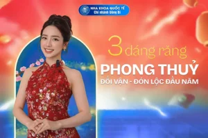 top 3 dáng răng phong thuỷ năm 2026