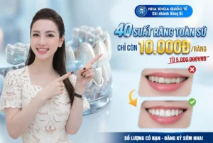 Khuyến mãi răng sứ 10k uông bí