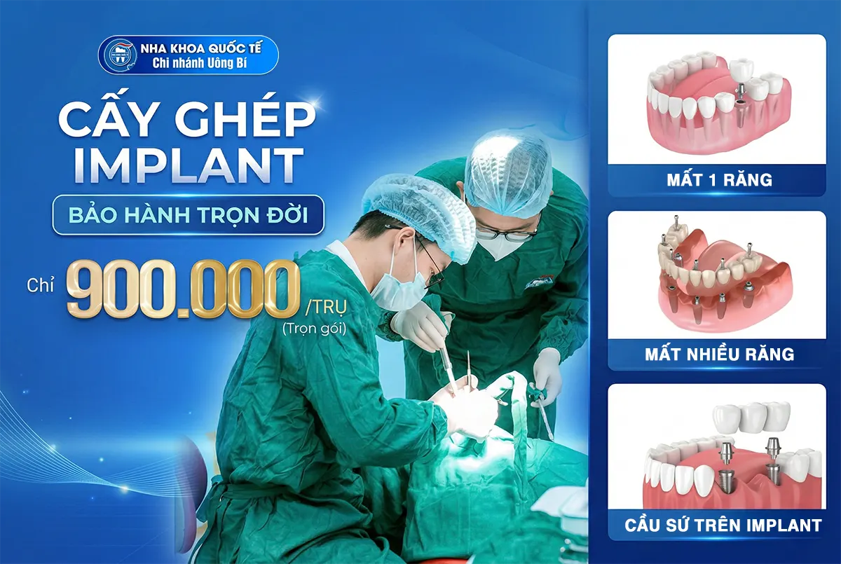 cấy ghép implant chỉ từ 900k tại uông bí
