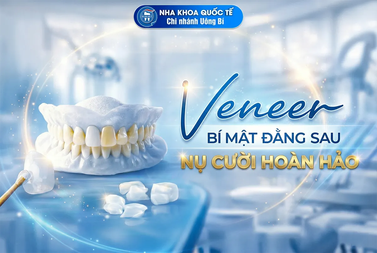 dán veneer đẹp