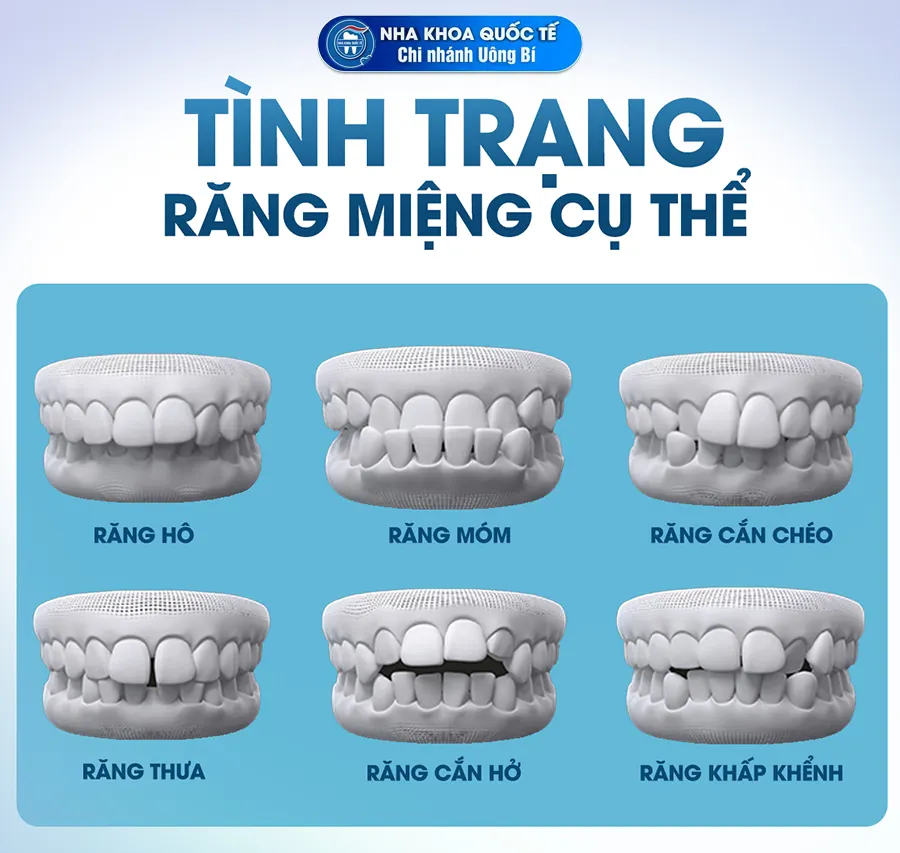 tình trạng răng miệng
