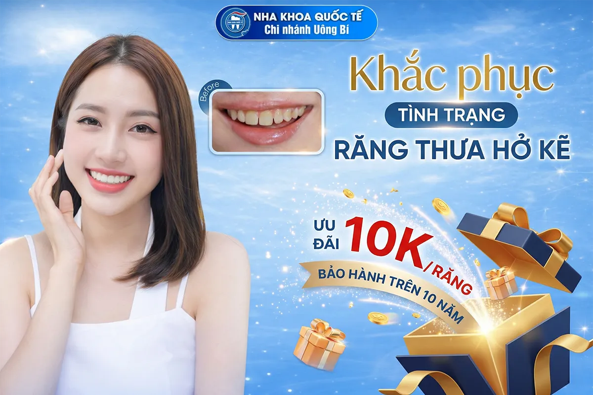 khắc phục răng thưa hở kẽ