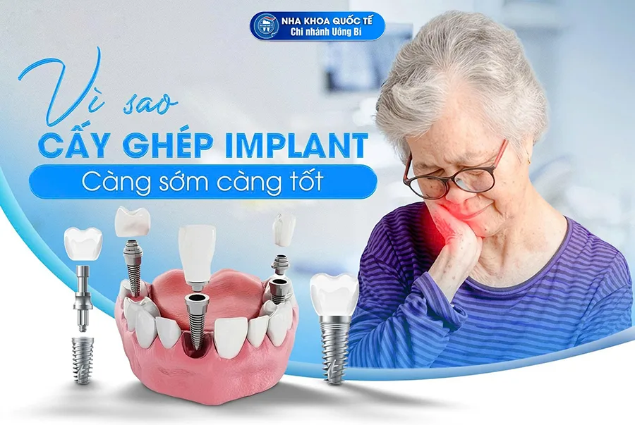 vì sao nên cấy ghép implant sớm