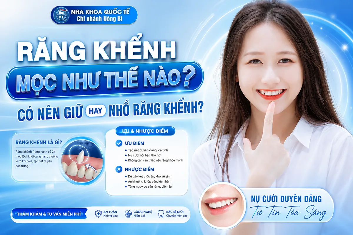 răng khểnh nên nhổ không