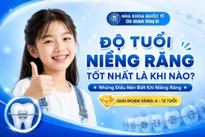 độ tuổi niềng răng tốt nhất