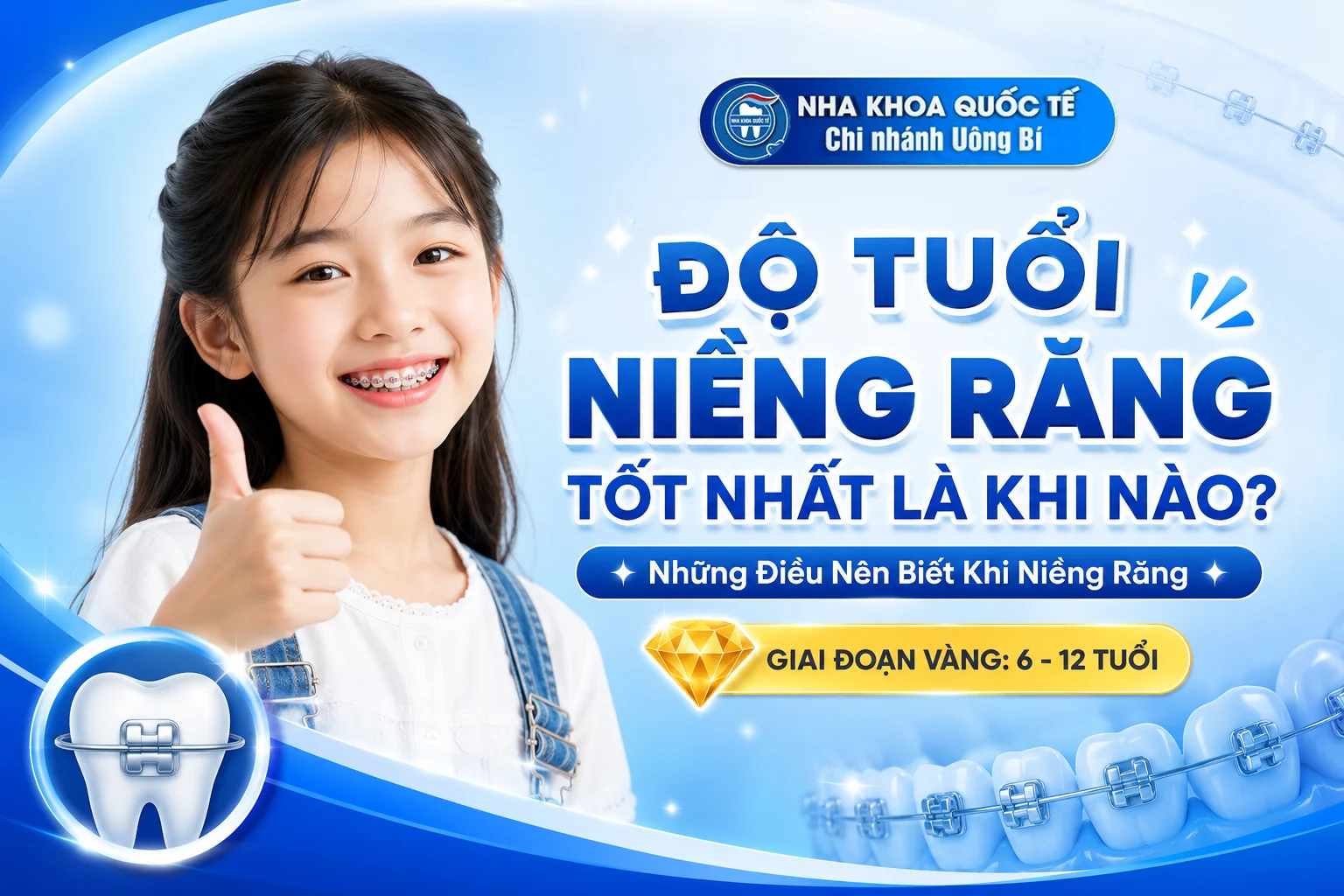 độ tuổi niềng răng tốt nhất