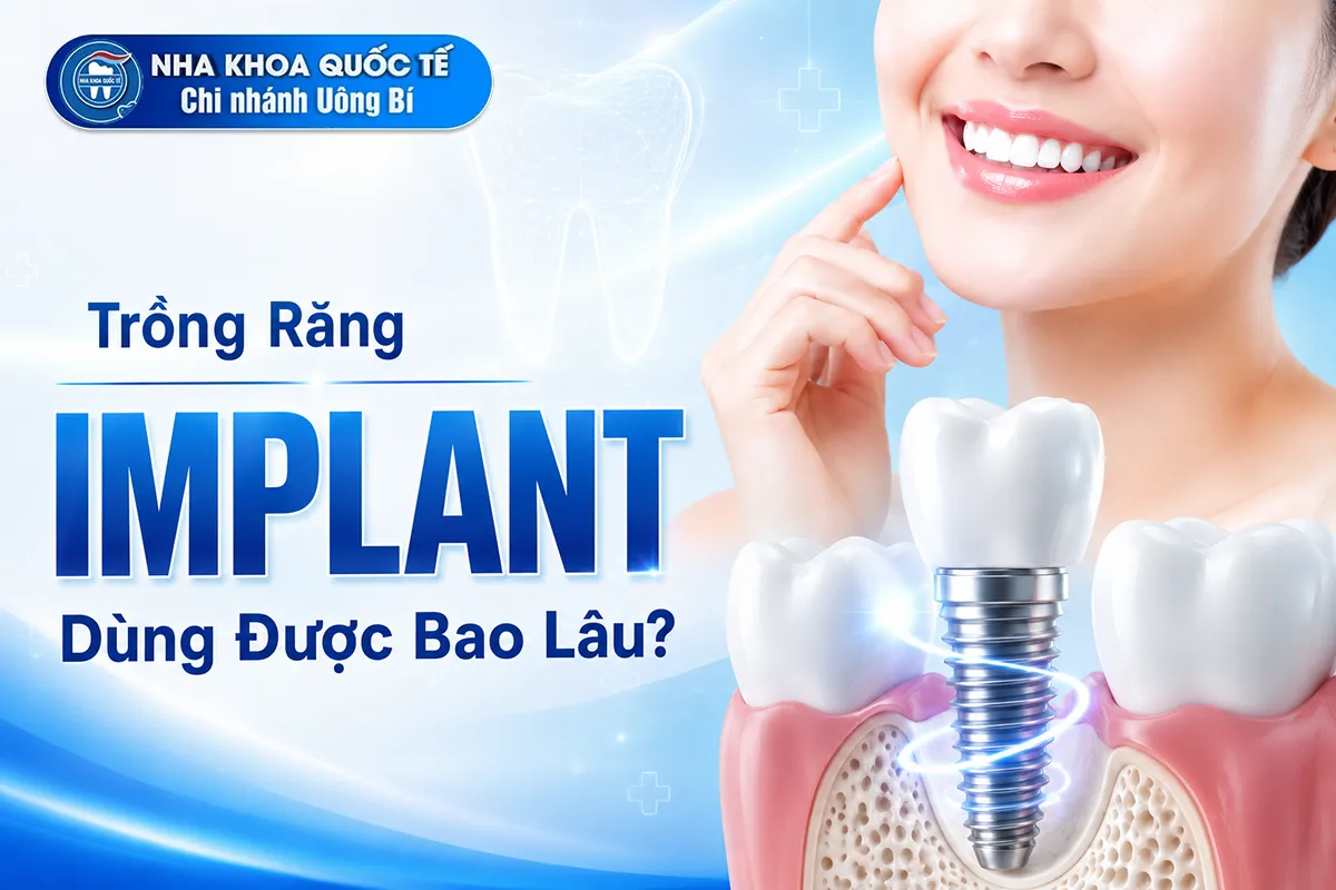 trồng implant dùng được bn lâu