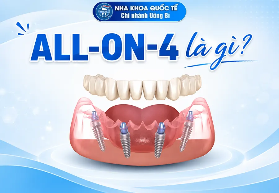 all on 4 la gi