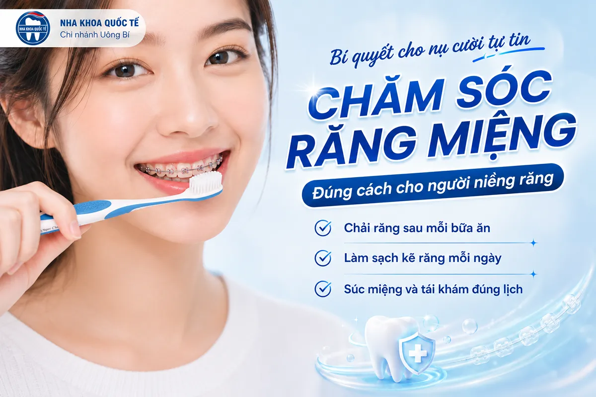 chăm sóc răng miệng khi niềng răng