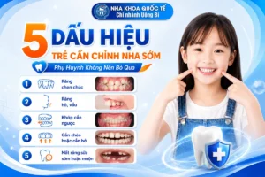5 dấu hiệu cần chỉnh nha sớm