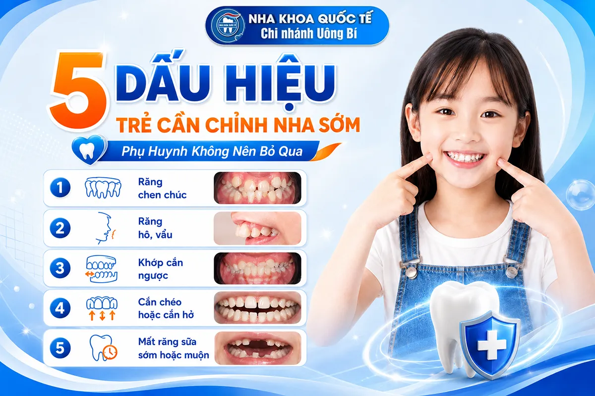 5 dấu hiệu cần chỉnh nha sớm