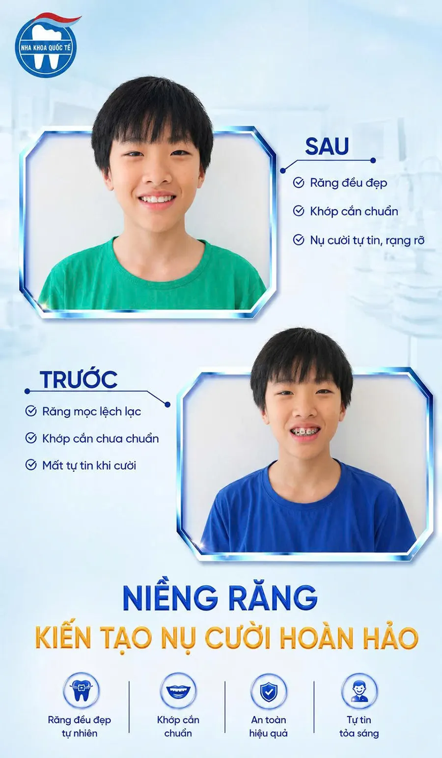 hiệu quả niềng răng