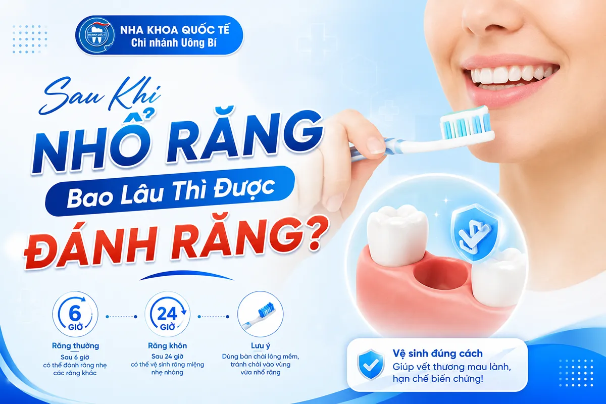 sau khi nhổ răng