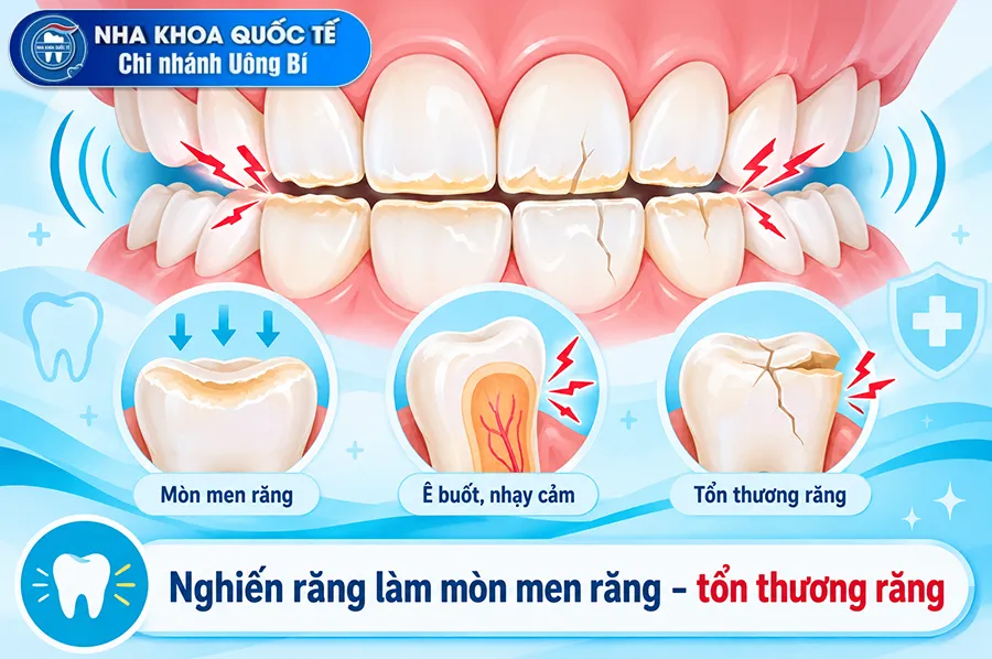 tác hại nghiến răng